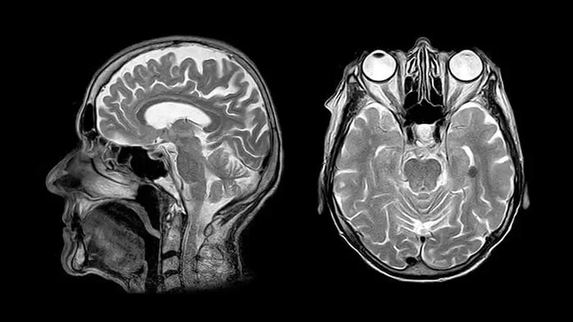 DICOM images in Python: An overview